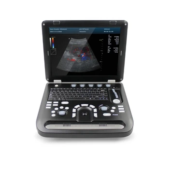 1700B 4D Spalva Doplerio USG Spalva Širdies Ultragarso Scanner Diagnostikos Mašina Sistemos Micro Išgaubti Zondas
